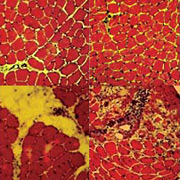 Молодые здоровые мышцы (вверху) носят розовый и красный оттенок, старые же (внизу) отмечены шрамами и воспалениями (жёлтые и затемнённые области) (фото Morgan Carlson/Irina Conboy, UC Berkeley).