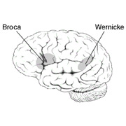 Исследование изменило привычный для многих расклад функций между зонами Брока и Вернике (иллюстрация Wikipedia).