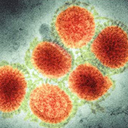 На мысль о применении подкислённой озонированной воды против вируса свиного гриппа (на снимке), по словам учёных, их вдохновили опыты с бактериями кишечной палочки, очень быстро погибавшими при контакте с нею (фото BBC).
