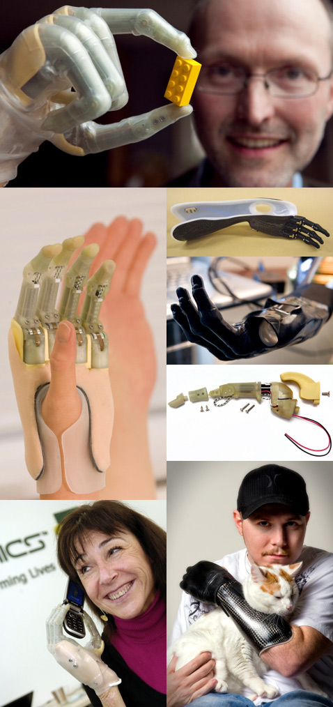 Эстетическую сторону вопроса компания предлагает решить с помощью силиконового покрытия <a href="http://www.touchbionics.com/LIVINGSKIN">LIVINGSKIN</a>, визуально почти неотличимого от человеческой кожи. Фанаты Дарта Вейдера, впрочем, могут выбрать дизайн пальцев в духе научной фантастики (фото Touch Bionics).