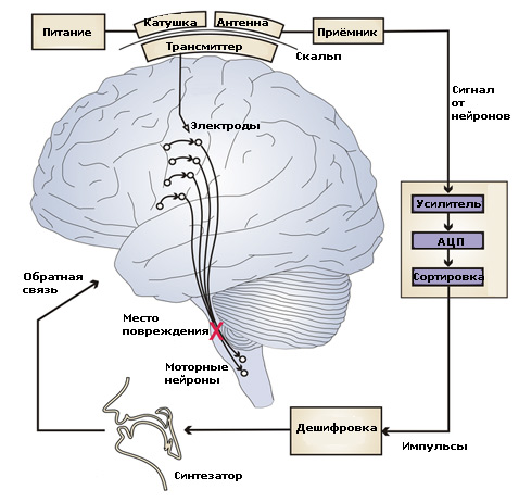 Схема мозгового интерфейса – синтезатора речи (иллюстрация Frank H. Guenther et al.).