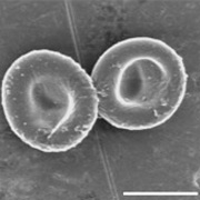 "Мягкая оболочка из белка делает полимерные клетки упругими и эластичными, – говорит Митраготри. – Как и настоящие клетки крови, они могут протиснуться через капилляры диаметром меньше, чем их собственный". Масштабная шкала – 5 микрометров (иллюстрация Nishit Doshi).