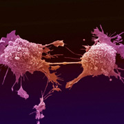 Так делятся клетки при раке лёгкого (фото Anne Weston, LRI, CRUK, Wellcome Images).