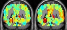 Срезы мозга показывают реальную активность регионов мозга (слева) и предсказанную теорией. Совпадение особенно заметно в двух обведённых кругами областях, соотносящихся с представлением об укрытии (иллюстрация Carnegie Mellon University).