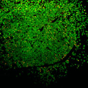 Клетки печени мыши были вытеснены человеческими (отмечены зелёным цветом), которые позже приняли на себя атаку вирусов гепатита B (показаны красным) (фото Karl-Dimiter Bissig, Salk Institute for Biological Studies).