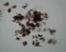 Вирус атакует белые кровяные клетки, известные под названием CD4+ T-лимфоциты (фото University of Michigan).