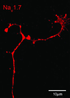 Натриевый канал внутри кончика аксона нервной клетки (фото Joel A. Black/Yale University).