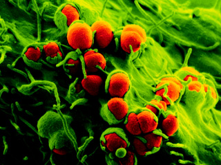 Микроорганизмам (на снимке в изменённых цветах показаны красным) пришлось преодолеть целый ряд препятствий, чтобы получить кусок ДНК человека. Осталось понять, зачем им это понадобилось (фото Billker et al./Nature).