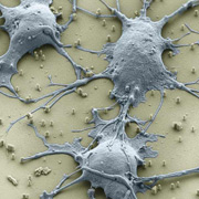 По всему выходит, что клетки, "высаженные" на нанопроводки, живут своей обычной жизнью, растут и делятся. Показанные здесь нейроны крысы (цвета изменены) даже образовали нормальные связи. Осталось понять, не воздействуют ли "иголки" на важные внутренние процессы клеток (фото Hongkun Park).