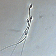 Некоторые сперматозоиды с готовностью объединяются в подобные этому "поезда", чтобы быстрее добраться до яйцеклетки самки грызуна (фото Fisher,Hoekstra/Nature).